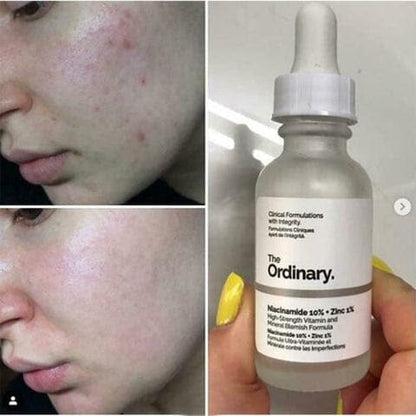 The Ordinary Niacinamide 10% + Zinc 1% Face Serum